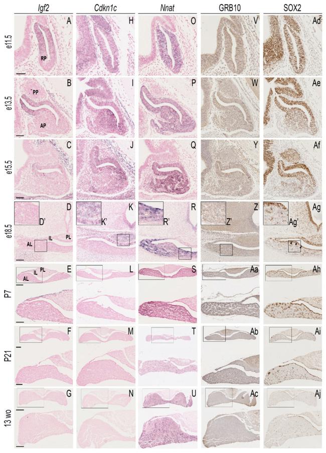 GRB10 Antibody in Immunohistochemistry (IHC)