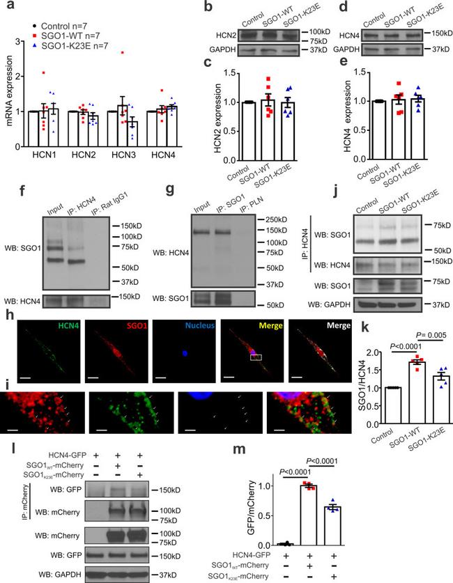 Phospholamban Antibody in Immunoprecipitation (IP)