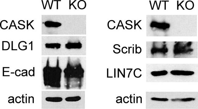 LIN7C Antibody in Western Blot (WB)