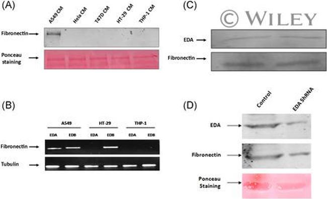 Fibronectin Antibody in Western Blot (WB)