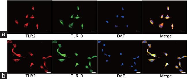TLR2 Antibody in Immunocytochemistry (ICC/IF)