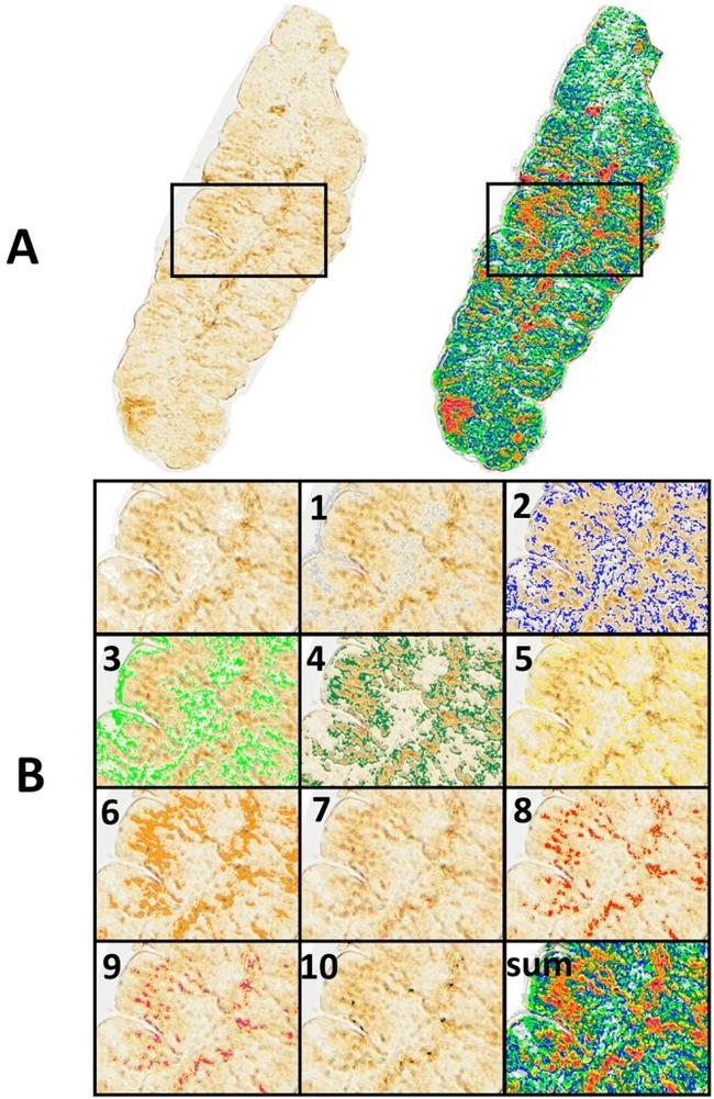 Haptoglobin Antibody in Immunohistochemistry (IHC)