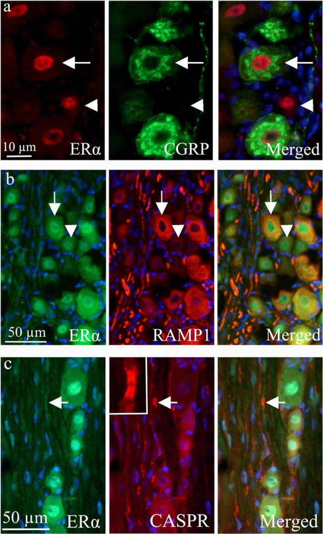 CGRP Antibody in Immunohistochemistry (IHC)