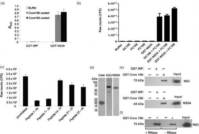 Hepatitis C Virus Core Antigen Antibody in ELISA (ELISA)