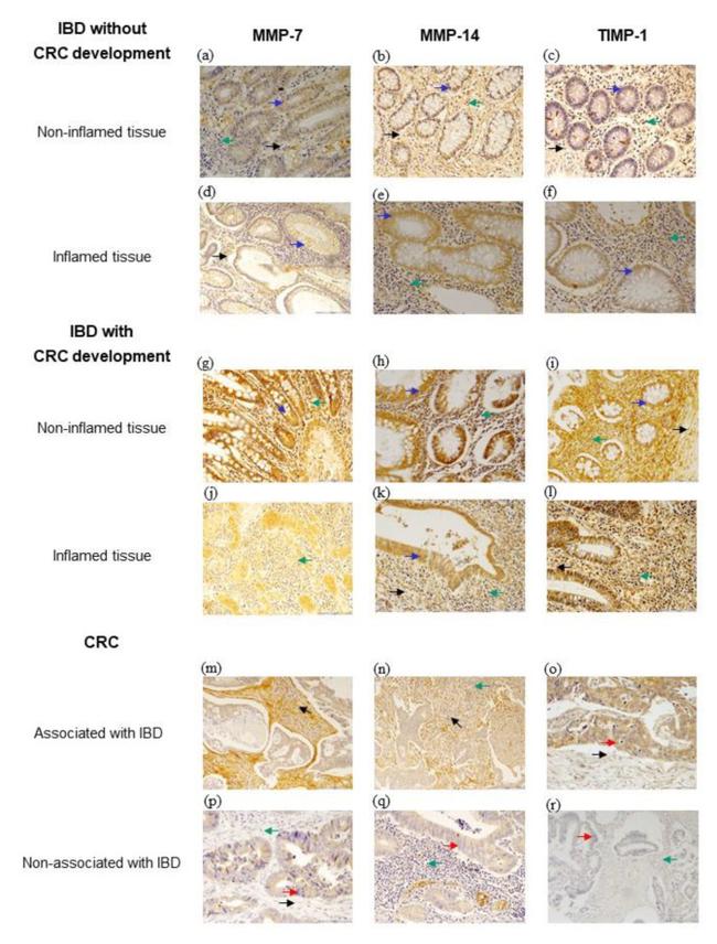 MMP7 Antibody in Immunohistochemistry (IHC)