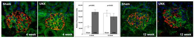 beta Galactosidase Antibody in Immunocytochemistry (ICC/IF)