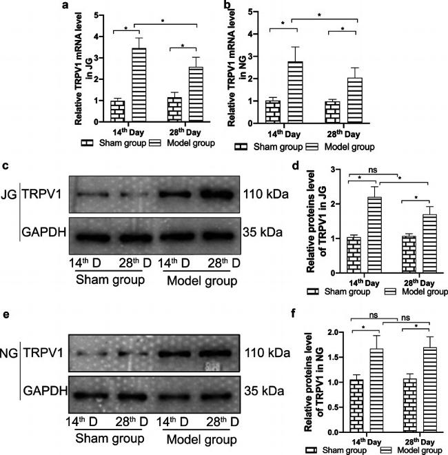 TRPV1 Antibody in Western Blot (WB)