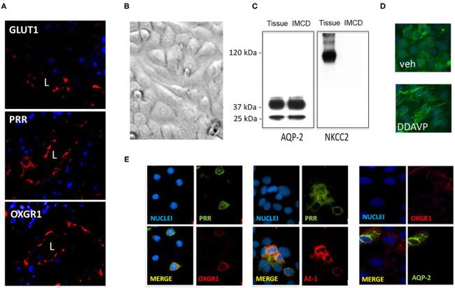 OXGR1 Antibody in Immunohistochemistry, Immunocytochemistry (IHC, ICC/IF)