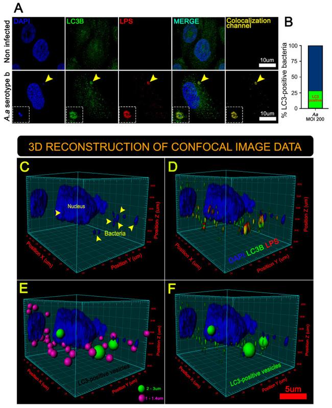 Lipid A LPS Antibody in Immunocytochemistry (ICC/IF)