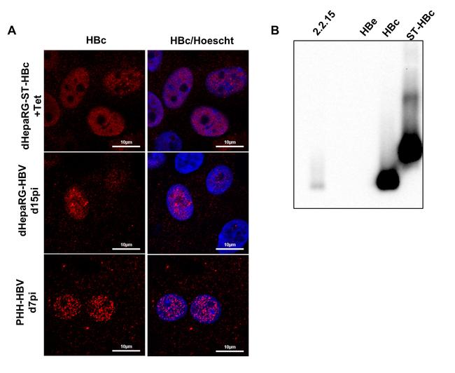 Hepatitis B Virus Core Antigen Antibody in Immunocytochemistry (ICC/IF)