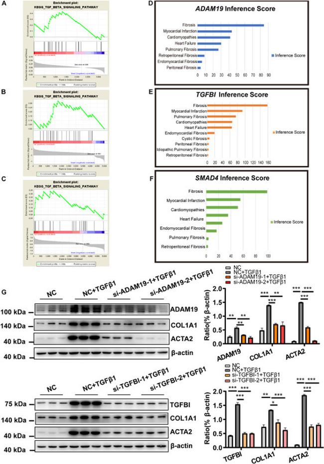 ADAM19 Antibody in Western Blot (WB)