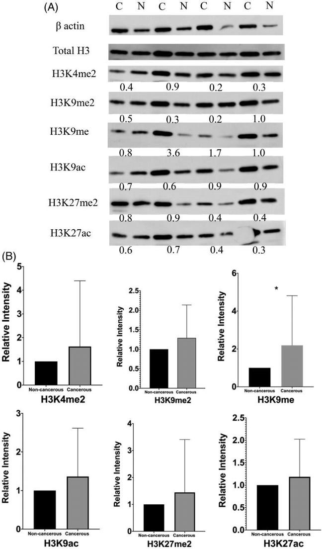 H3K27me2 Antibody in Western Blot (WB)