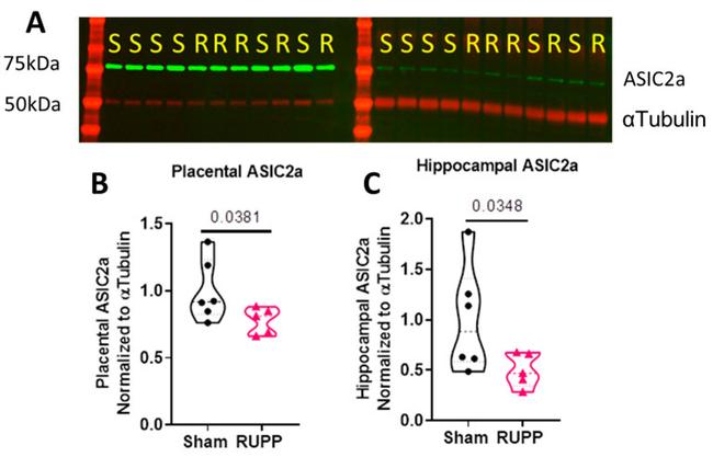 ASIC1 Antibody in Western Blot (WB)