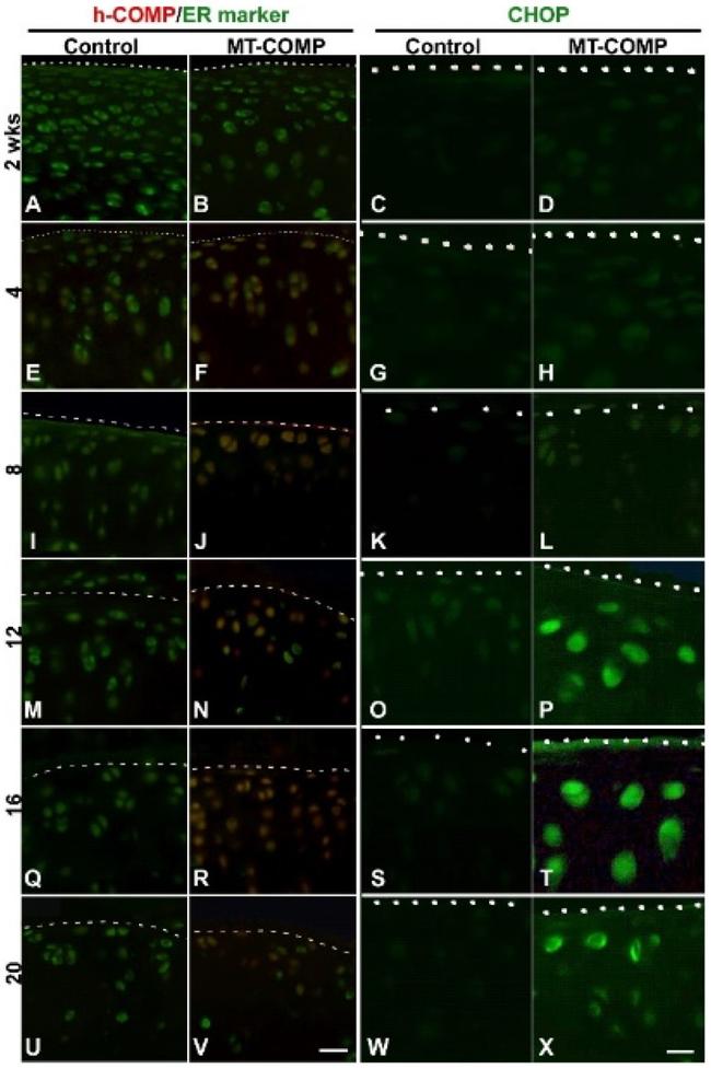 COMP Antibody in Immunohistochemistry (IHC)
