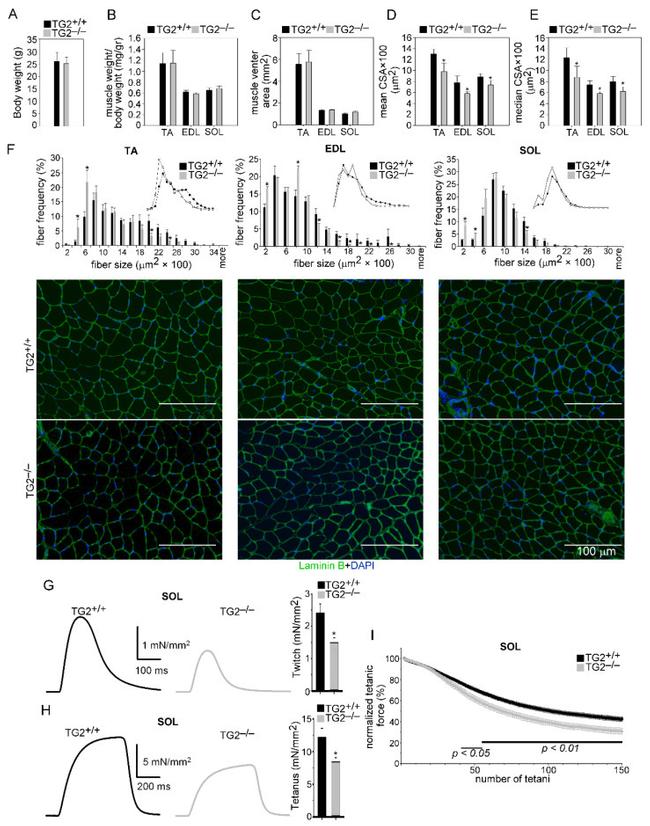 Laminin Antibody in Immunohistochemistry (IHC)