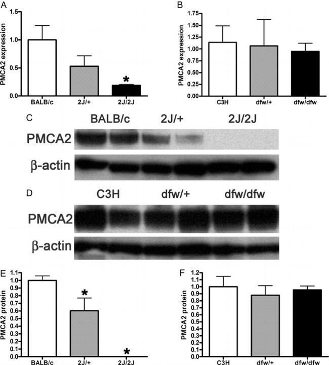PMCA2 ATPase Antibody in Western Blot (WB)