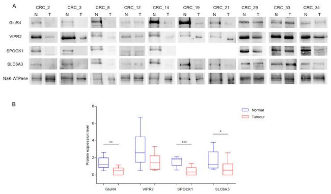 SPOCK1 Antibody in Western Blot (WB)