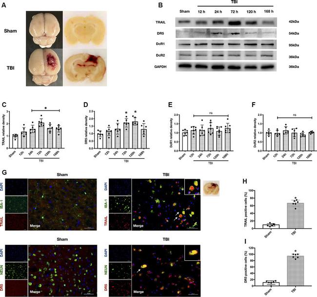TRAIL (CD253) Antibody in Western Blot, Immunohistochemistry (WB, IHC)