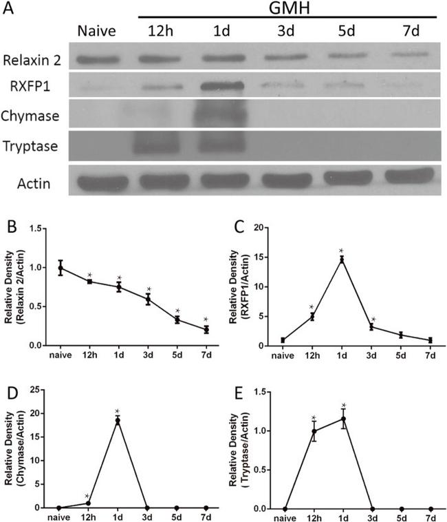Relaxin 2 Polyclonal Antibody (PA5-76483)