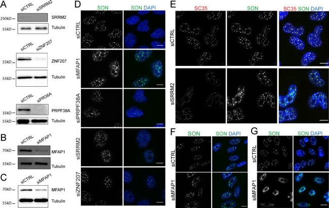 SRRM2 Antibody in Western Blot (WB)