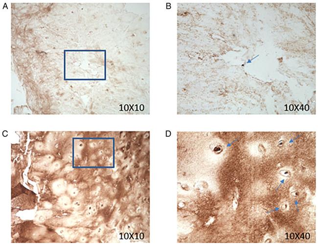 CILP Antibody in Immunohistochemistry (IHC)