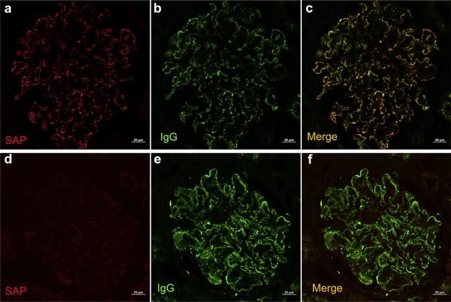 Serum Amyloid P Antibody in Immunohistochemistry (IHC)
