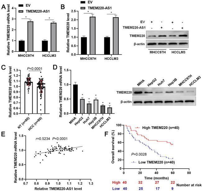 TMEM220 Antibody in Western Blot (WB)