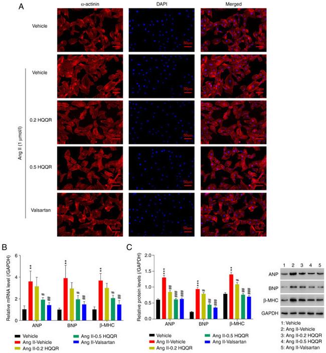 Cardiac Myosin Heavy Chain Antibody in Western Blot (WB)