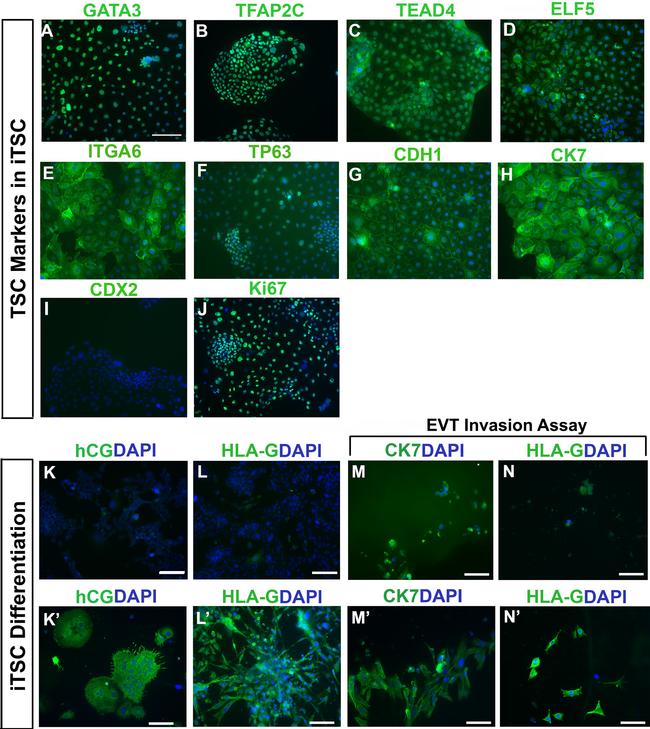 hCG beta Antibody in Immunocytochemistry (ICC/IF)