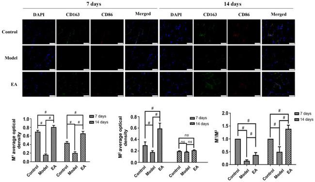 CD163 Antibody in Immunohistochemistry, Immunohistochemistry (Paraffin) (IHC, IHC (P))