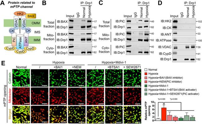 ANT Antibody in Western Blot (WB)