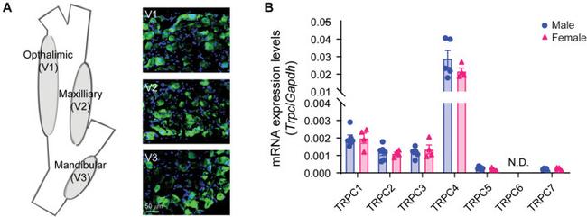 TRPC4 Antibody in Immunohistochemistry (IHC)