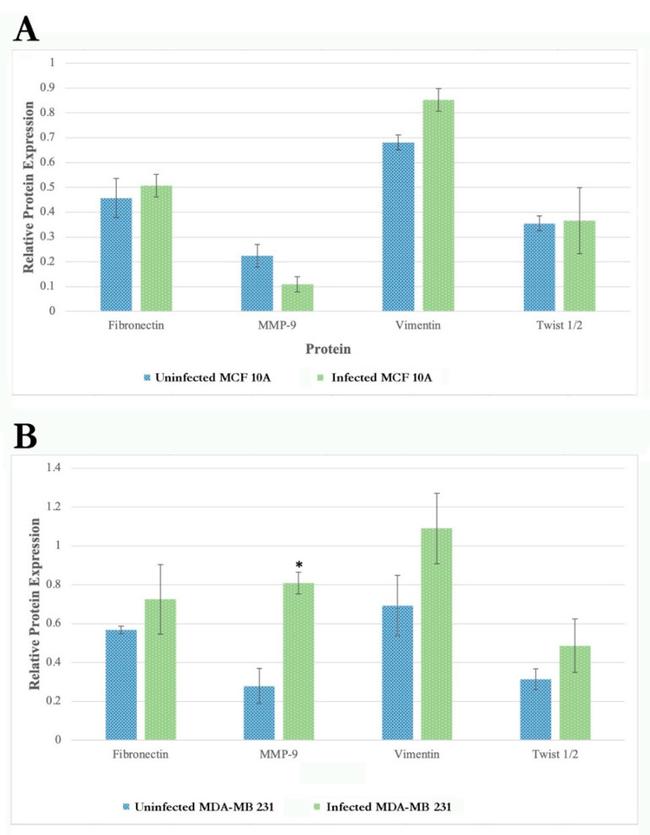 MMP9 Antibody in Western Blot (WB)