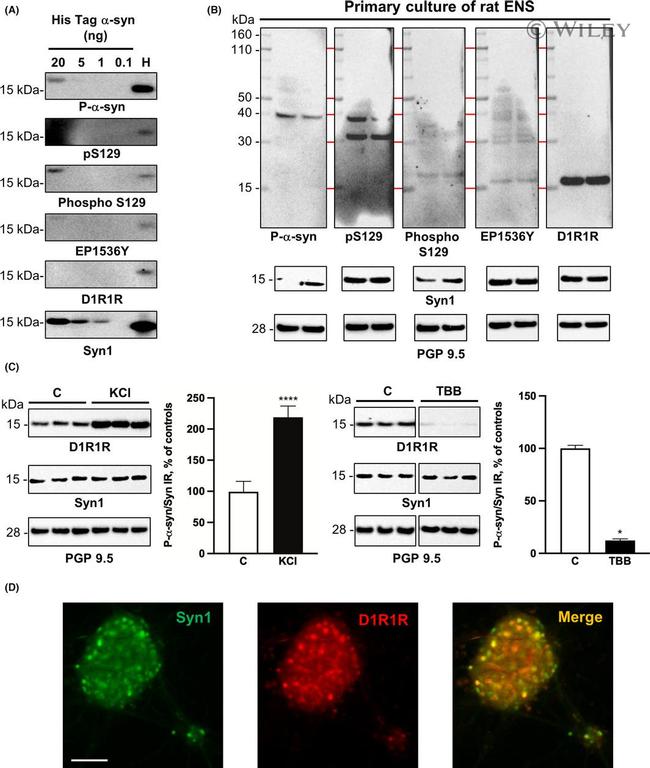 Phospho-alpha Synuclein (Ser129) Antibody in Western Blot (WB)