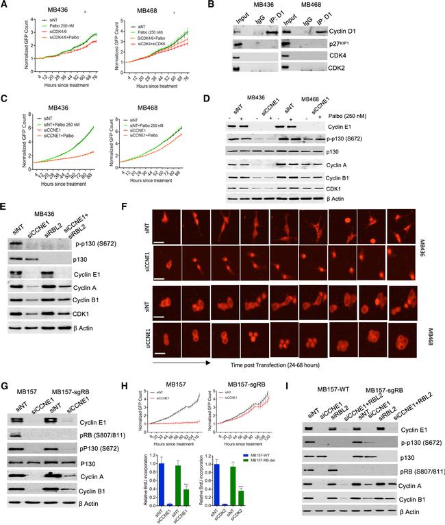 Cyclin D1 Antibody in Western Blot, Immunoprecipitation (WB, IP)