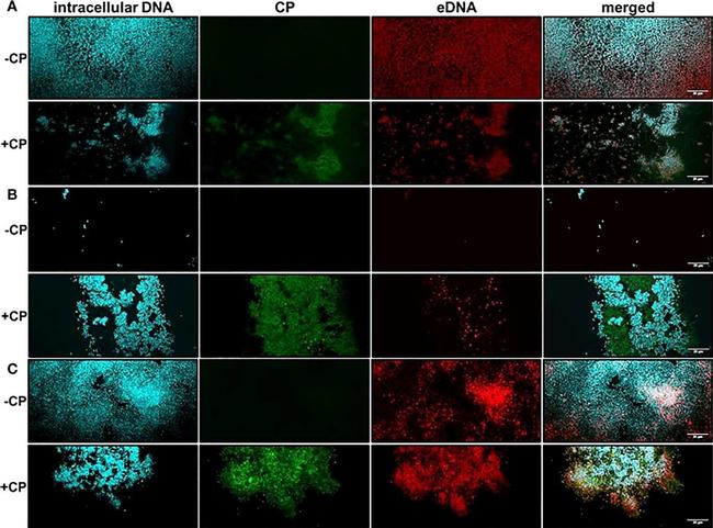 Rabbit IgG (H+L) Secondary Antibody in Immunocytochemistry (ICC/IF)