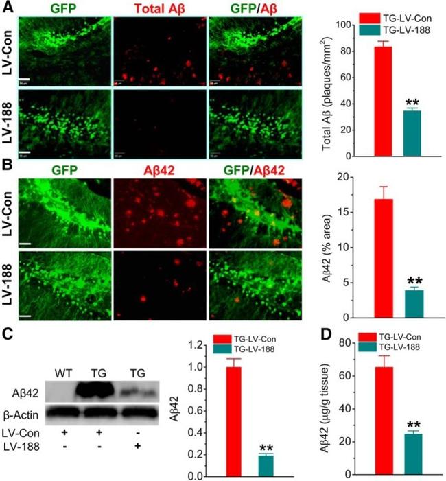 beta Amyloid (1-42) Antibody in Western Blot, Immunohistochemistry - Free Floating, Immunocytochemistry (WB, IHC (Free), ICC/IF)