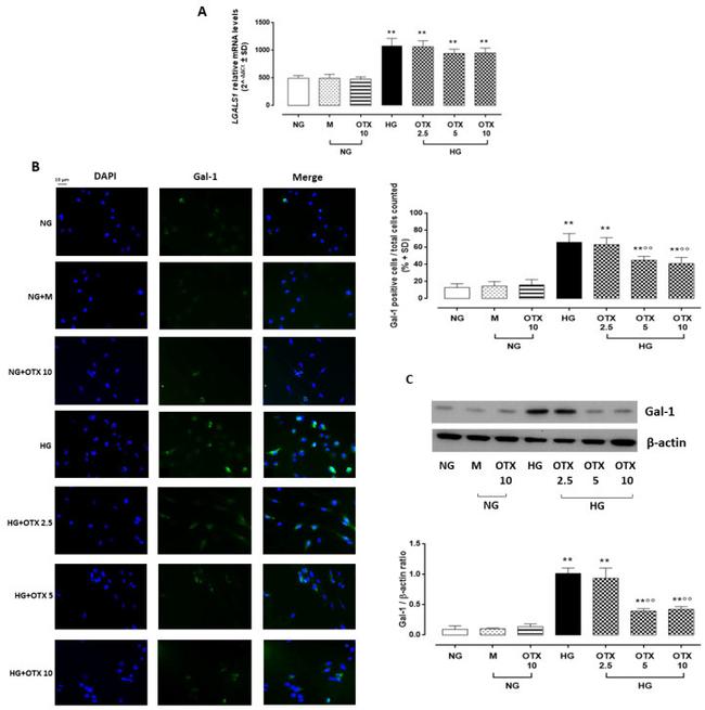 Galectin 1 Antibody in Western Blot, Immunocytochemistry (WB, ICC/IF)