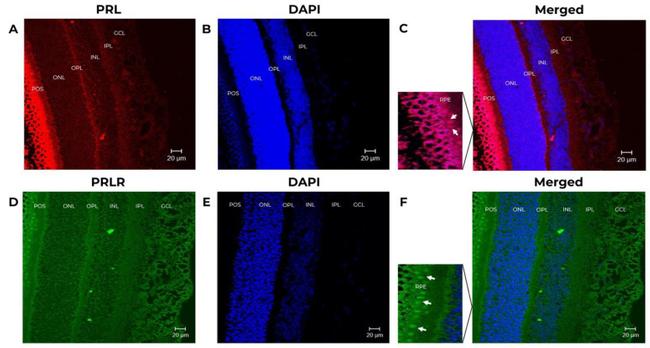 Prolactin Antibody in Immunohistochemistry (IHC)