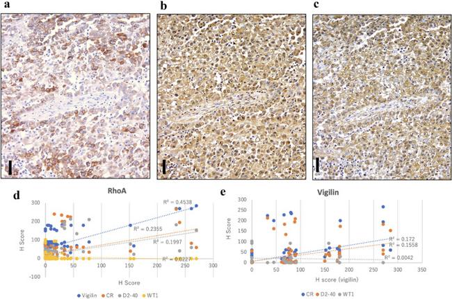 Calretinin Antibody in Immunohistochemistry (IHC)