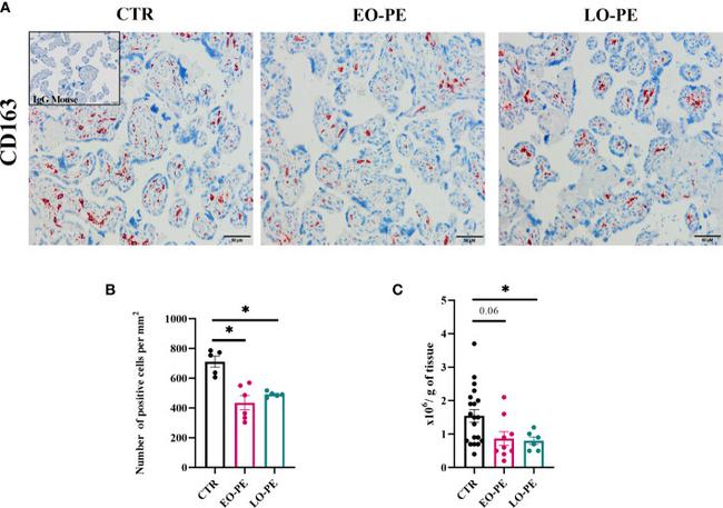 CD163 Antibody in Immunohistochemistry (IHC)