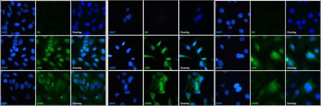 uPAR Antibody in Immunocytochemistry (ICC/IF)