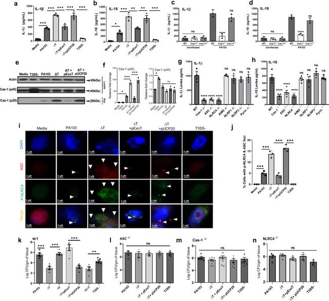NLRC4 Antibody in Immunohistochemistry (IHC)