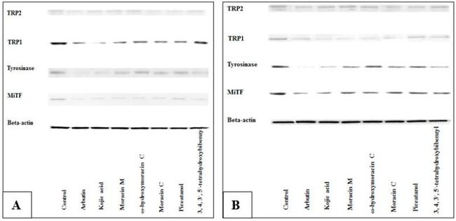 TRPC1 Antibody in Western Blot (WB)