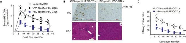 Hepatitis B Virus Surface Antibody in Immunohistochemistry (IHC)