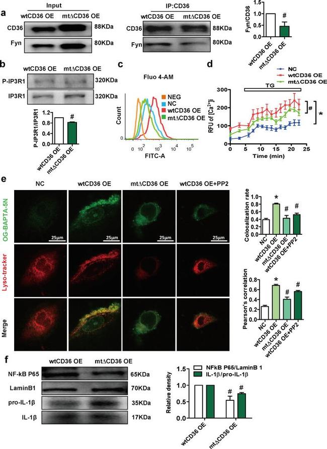 Phospho-IP3 Receptor 1 (Tyr353) Antibody in Western Blot (WB)