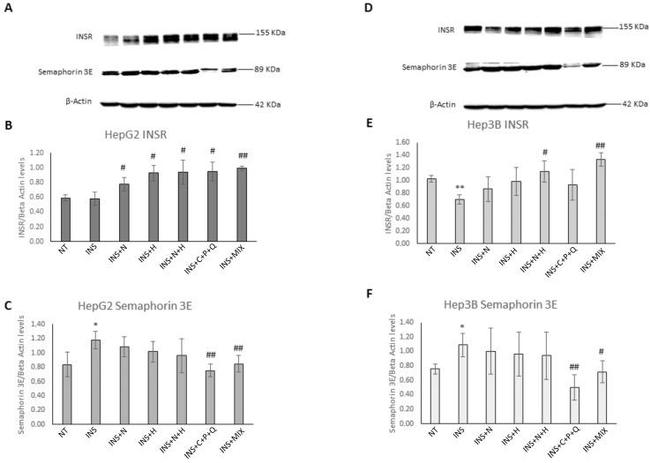 INSR Antibody in Western Blot (WB)