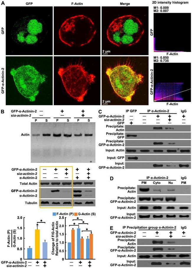 alpha Actinin 2 Antibody in Western Blot, Immunoprecipitation (WB, IP)