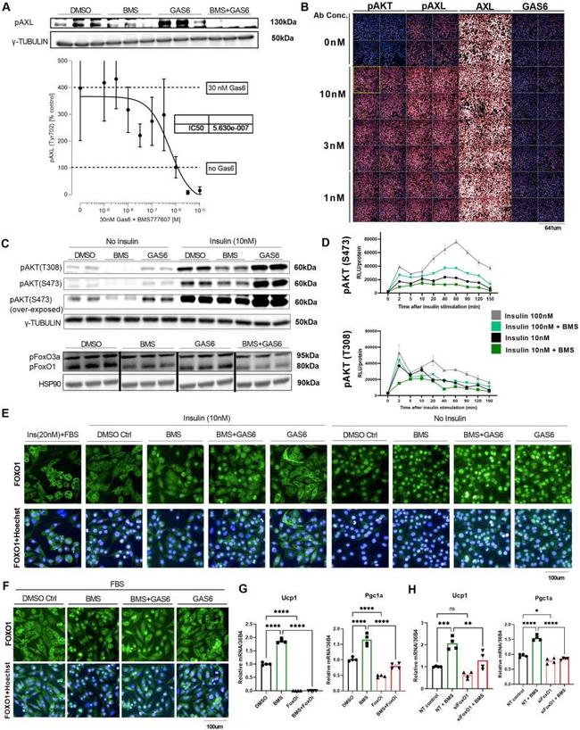 Phospho-Axl (Tyr702) Antibody in Western Blot (WB)