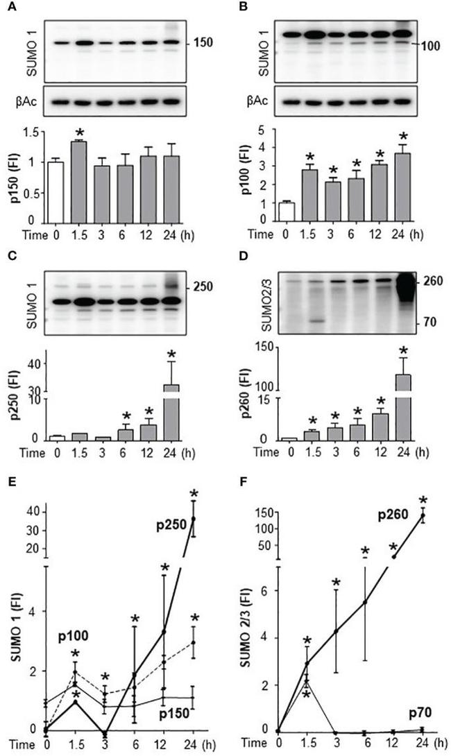 SUMO1 Antibody in Western Blot (WB)